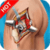 Virtual Surgery - Hip Surgery