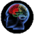 Migraine