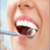 Ulcers
