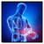 Arthritis Disease