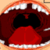 Extraction Of Teeth