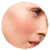Healthy Cheek